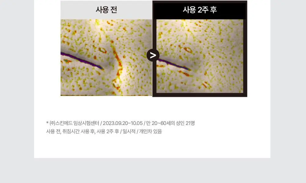 [2주주름패치] 휴캄 킨츠키 하트 탄력패치 (24매) 상세페이지 12